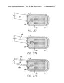 Flexible Circuit Electrode Array with Wire or Film Support diagram and image