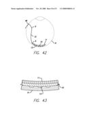 Flexible Circuit Electrode Array with Wire or Film Support diagram and image