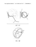 Flexible Circuit Electrode Array with Wire or Film Support diagram and image