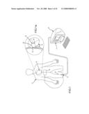 Method for Displaying Catheter Electrode-Tissue Contact in Electro-Anatomic Mapping and Navigation System diagram and image