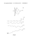 Method for Displaying Catheter Electrode-Tissue Contact in Electro-Anatomic Mapping and Navigation System diagram and image