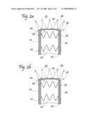 Composite Stent Graft diagram and image