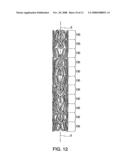 STENT HAVING HELICAL ELEMENTS diagram and image