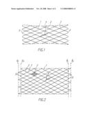 Stent diagram and image