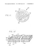 MEDICATED POROUS METAL PROSTHESIS AND A METHOD OF MAKING THE SAME diagram and image