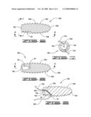 Threaded pulley anchor apparatus and method for use in surgical repair of ligament or tendon diagram and image