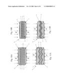 INTERNALLY REINFORCED ELASTOMERIC INTERVERTEBRAL DISC IMPLANTS diagram and image