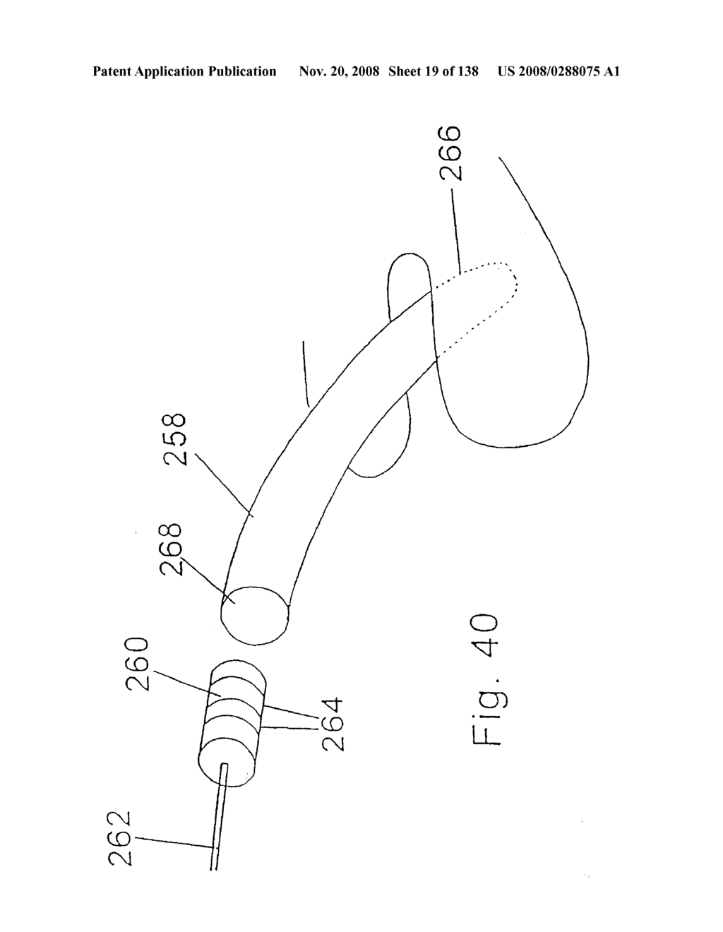 SPINE DISTRACTION IMPLANT AND METHOD - diagram, schematic, and image 21