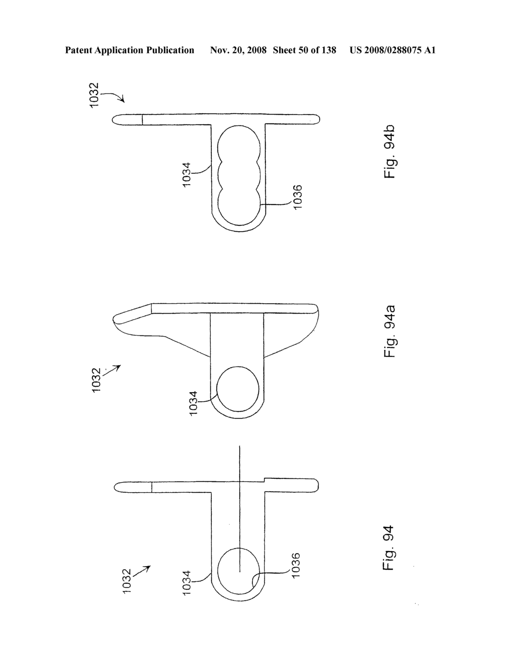 SPINE DISTRACTION IMPLANT AND METHOD - diagram, schematic, and image 52