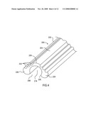 OPEN LUMEN STENT diagram and image