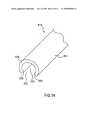 OPEN LUMEN STENT diagram and image