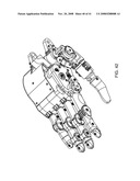 ARM PROSTHETIC DEVICE diagram and image
