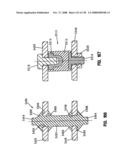 LIFT SYSTEM FOR HOSPITAL BED diagram and image