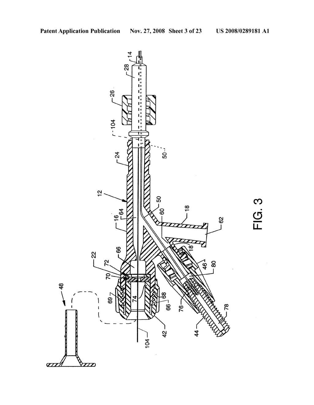 METHOD OF MANUFACTURING A MINIATURE FLEXIBLE THROMBECTOMY CATHETER - diagram, schematic, and image 04