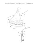 TRIMMER SKIRT diagram and image