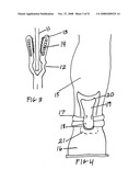 Hem and clothing protector diagram and image