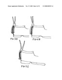 Hem and clothing protector diagram and image