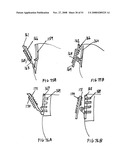 Hem and clothing protector diagram and image