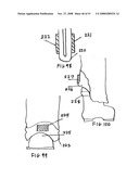 Hem and clothing protector diagram and image