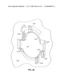 APPARATUS AND METHOD FOR RESPIRATORY TRACT THERAPY diagram and image