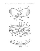 MOUTHGUARD diagram and image