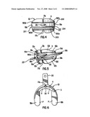 MOUTHGUARD diagram and image