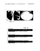 Novel Manufacturing Design and Processing Methods and Apparatus for Sputtering Targets diagram and image