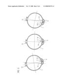 Encapsulating Housing for an Electrical Power Transmission Device Having a Particle Trap diagram and image