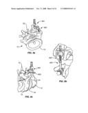 IMPLANTABLE ORTHOPEDIC DEVICE COMPONENT SELECTION INSTRUMENT AND METHODS diagram and image