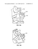 IMPLANTABLE ORTHOPEDIC DEVICE COMPONENT SELECTION INSTRUMENT AND METHODS diagram and image