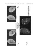 Method and Computer Program Product for Registering Biomedical Images with Reduced Imaging Artifacts Caused by Object Movement diagram and image