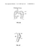 Systems and methods for intra-oral drug delivery diagram and image