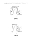 Systems and methods for intra-oral drug delivery diagram and image