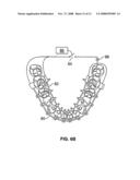 Systems and methods for intra-oral drug delivery diagram and image