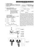 Splint Abutment Over Osseointegrated Implant and Compensatory Slated Coping diagram and image