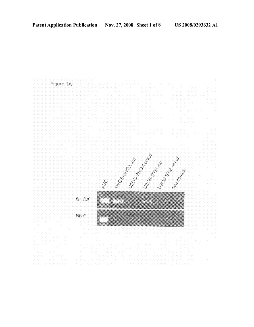 Use of natriuretic peptides for the treatment of stature disorders related to shox gene - diagram, schematic, and image 02