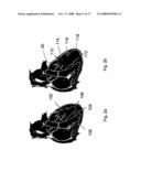 SYSTEMS AND METHODS FOR VOLUME REDUCTION diagram and image