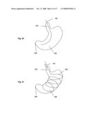 SYSTEMS AND METHODS FOR VOLUME REDUCTION diagram and image