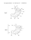 SYSTEMS AND METHODS FOR VOLUME REDUCTION diagram and image