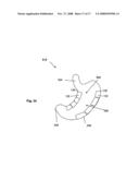 SYSTEMS AND METHODS FOR VOLUME REDUCTION diagram and image