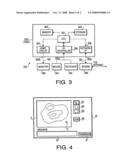 ENDOSCOPE SUPPORT SYSTEM diagram and image