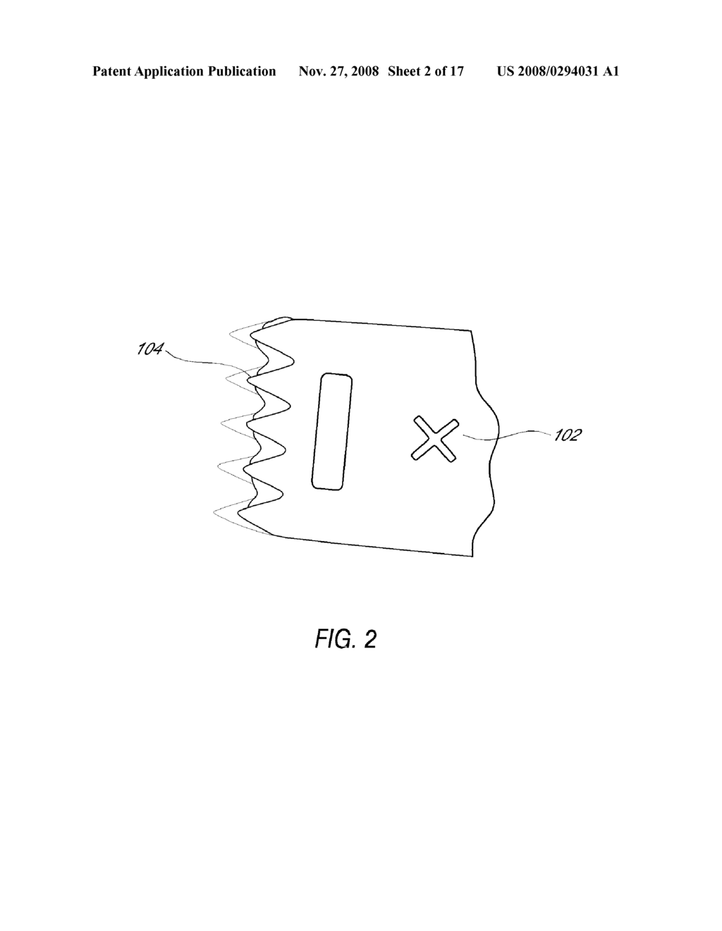 METHOD AND DEVICE FOR QUICK PRESS ON EEG ELECTRODE - diagram, schematic, and image 03