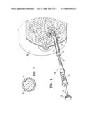 Assembly with hemostatic and radiographically detectable pellets diagram and image