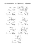 Body fluid sampling module with a continuous compression tissue interface surface diagram and image