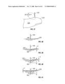 Body fluid sampling module with a continuous compression tissue interface surface diagram and image