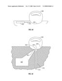 Body fluid sampling module with a continuous compression tissue interface surface diagram and image