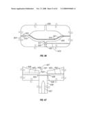 Body fluid sampling module with a continuous compression tissue interface surface diagram and image