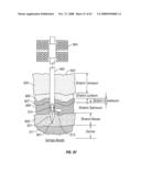 Body fluid sampling module with a continuous compression tissue interface surface diagram and image