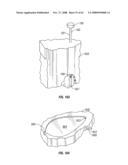 Body fluid sampling module with a continuous compression tissue interface surface diagram and image