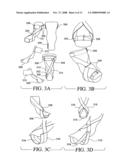 Orthopedic device diagram and image